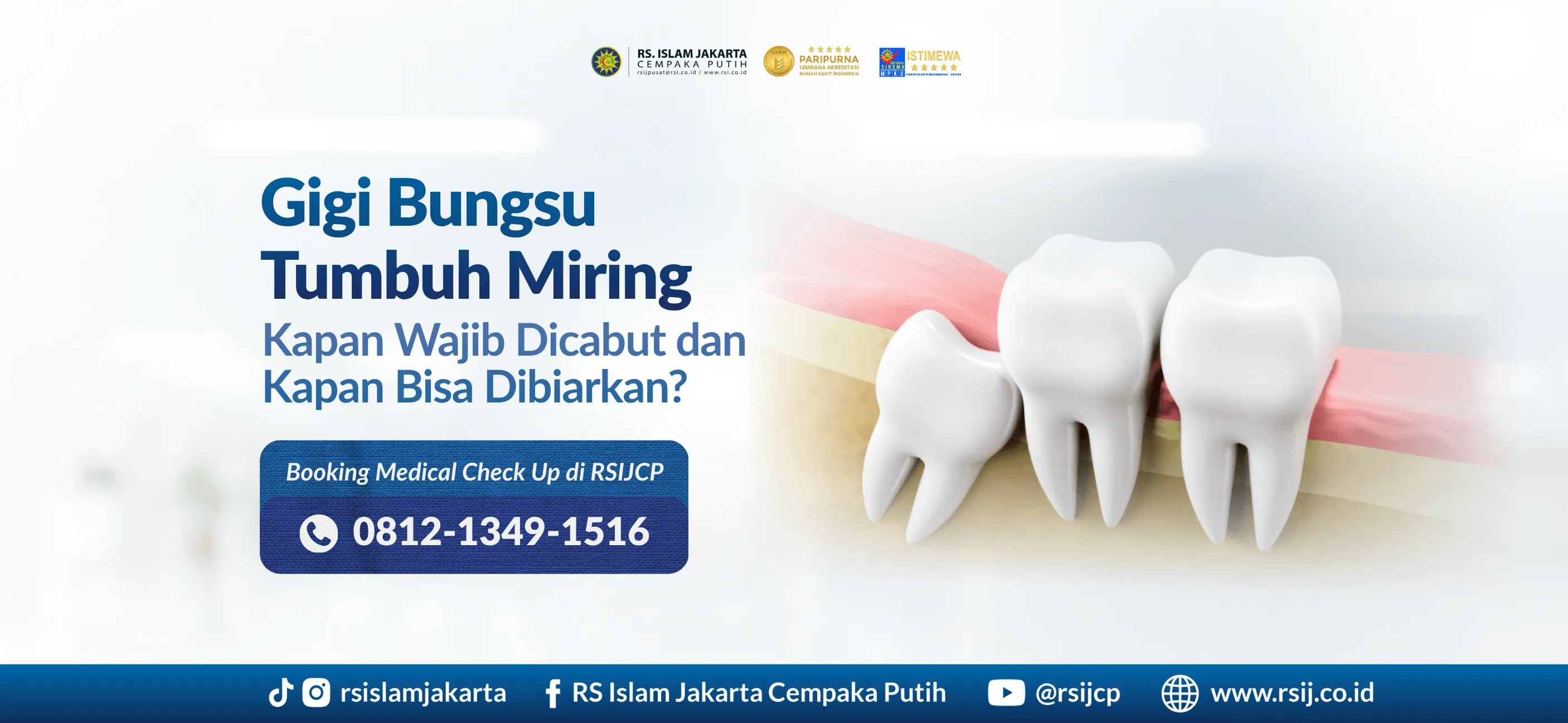 Gigi Bungsu Tumbuh Miring: Kapan Wajib Dicabut dan Kapan Bisa Dibiarkan?