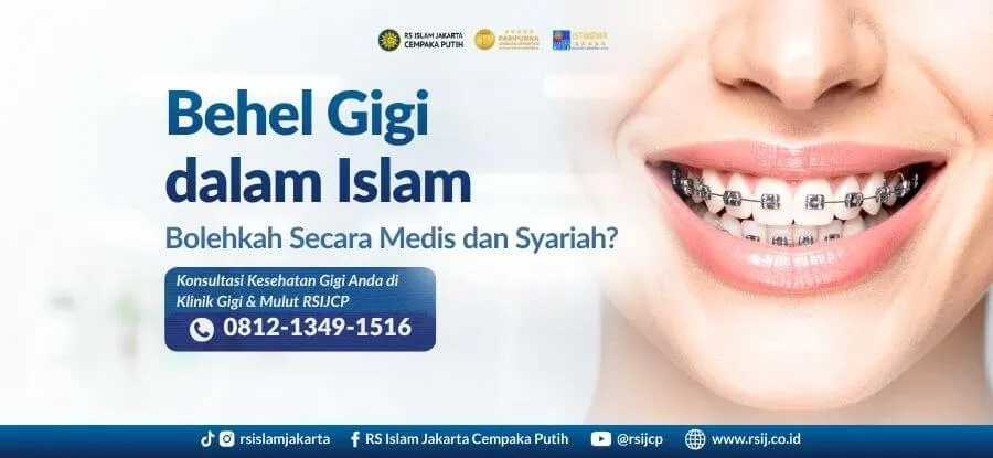 Behel Gigi Halal dalam Islam: Bolehkah? Penjelasan Medis dan Syariah